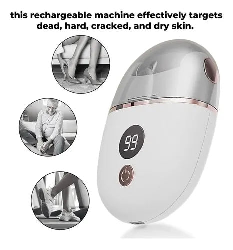Rechargeable Digital Display Electric Foot Grinder New Household Reusable Foot Repairer